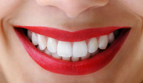Teeth Whitening Melbourne